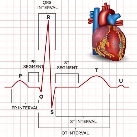 Basics Of Ecg Ekg Explained Ecg Ecgbasics Cardiology Qrscomplex