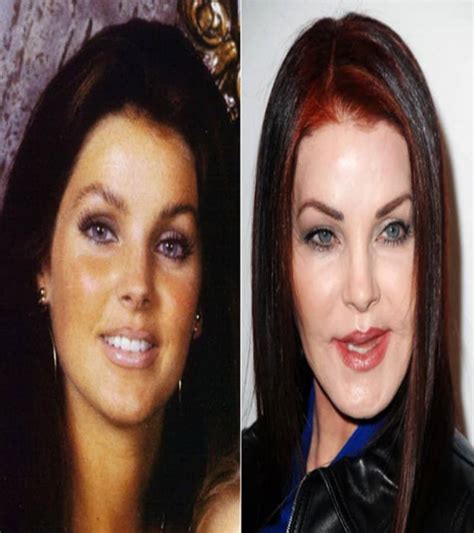 20 Of The Worst Celebrity Plastic Surgery Disasters Viralcola