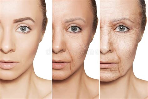 Concept Skin Aging Anti Aging Procedures Rejuvenation Lifting