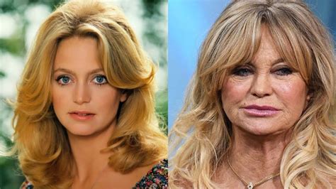 Celebrities Who Have Aged The Worst Celebrities Then And Now Vrogue