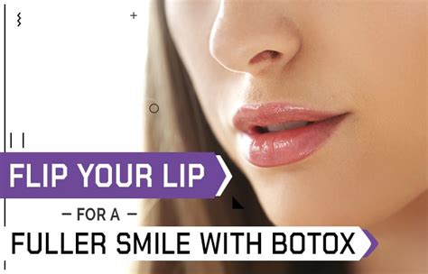 Flip Your Lip For A Fuller Smile With Botox Winston Salem Dermatology