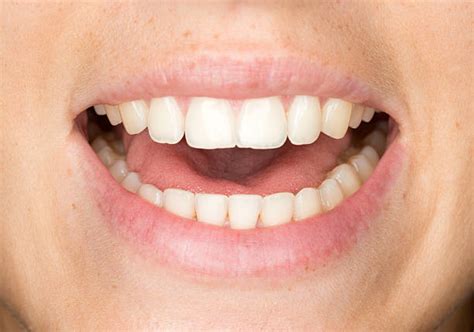 Mouth Open Pictures Images And Stock Photos Istock