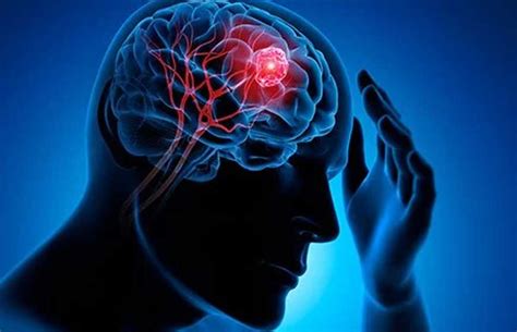 How Are Brain Tumours Caused And How Can They Be Treated