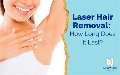 how long does laser hair removal last skin works medical spa