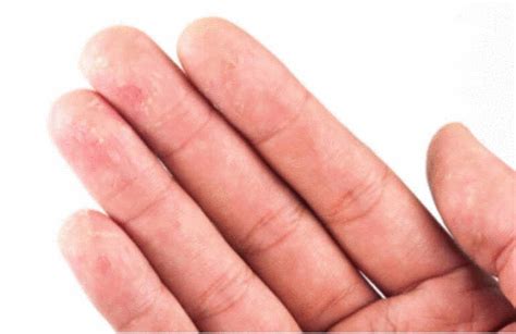 Ламбер вильсон, кристин скотт томас, жюль беншетри и др. Soin des ongles et des doigts - ToutPratique
