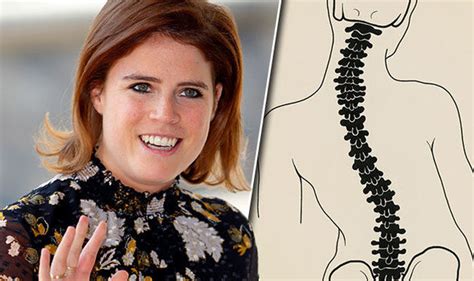 Princess Eugenie Wedding Eugenie Scoliosis Scar Visible In Her Dress