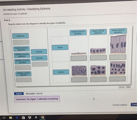 Drag the labels to identify the structures of a long bone. Anatomy And Physiology Archive | September 18, 2017 ...