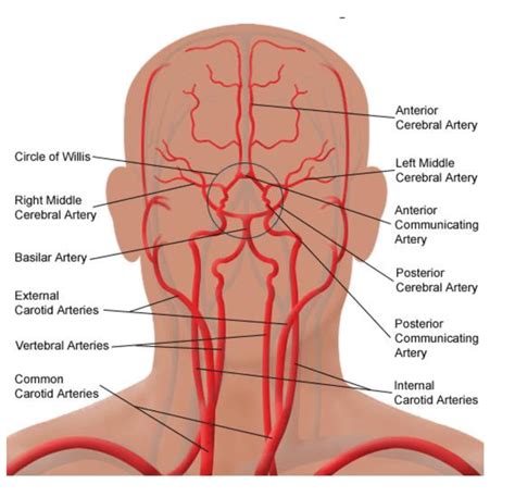 An artery (plural arteries) (from greek ἀρτηρία (artēria) 'windpipe, artery') is a blood vessel that takes blood away from the heart to one or more parts of the body (tissues, lungs, brain etc.). Organization of the human cerebral circulation. The brain ...