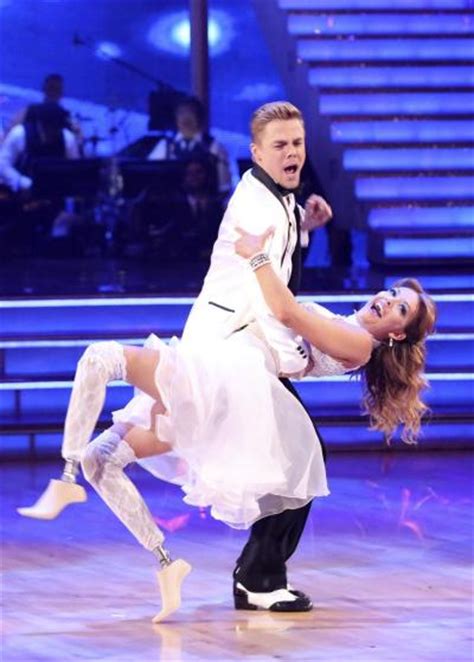 Pva Prosthetics Dancing With The Stars Contestant Inspires Amputees