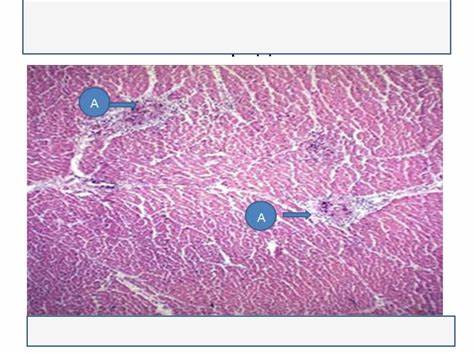 Астроцитома. Менингиома - online presentation Картинка - Астроцитома. Менингиома - online presentation