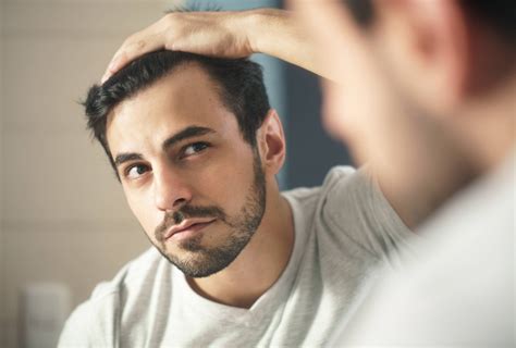 Early Signs Of Balding 10 Signs Youre Starting To Lose Your Hair Ds