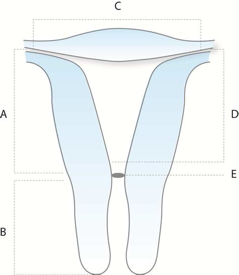 Anatomical Map Of Uterine Cavity Measurements A Endometrial Cavity Download Scientific