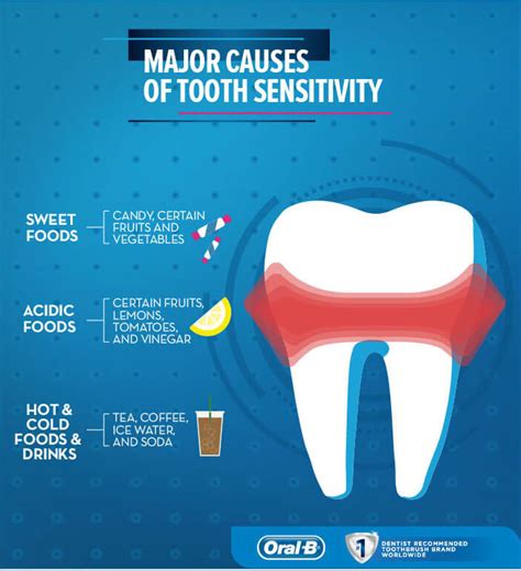 top 10 causes of sensitive teeth gps dental