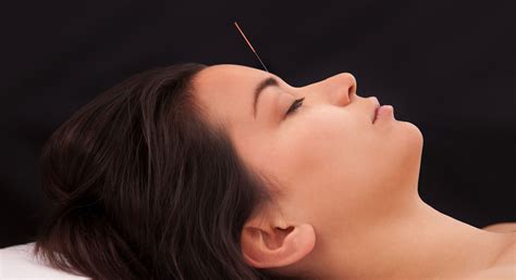 Acupuncture Banbury And Chipping Norton Oxfordshire