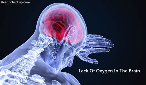 Lack Of Oxygen In The Brain Symptoms Causes Treatment Side Effects