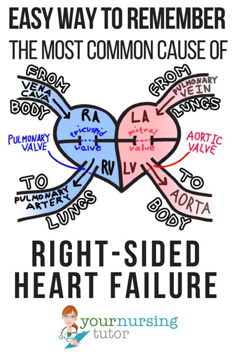 Symptoms of heart failure (at rest or during exercise). Easily Remember the Most Common Cause of Right-Sided Heart ...