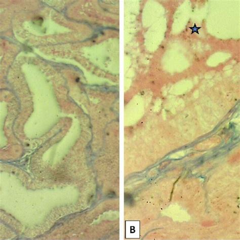 Section Of Vesicular Gland Mature Donkey Shows Inter Alveolar