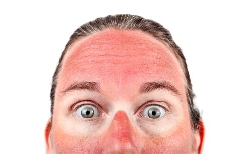 Sun Damaged Skin And Why You Need Checked Immediately The Dermatology