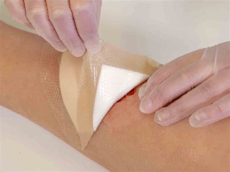 How to change wound dressings Mölnlycke Advantage