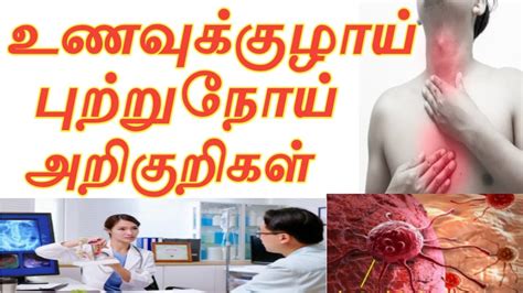 Unavu Kulai Cancer Symptoms In Tamilcancer Symptoms In Tamilcancer