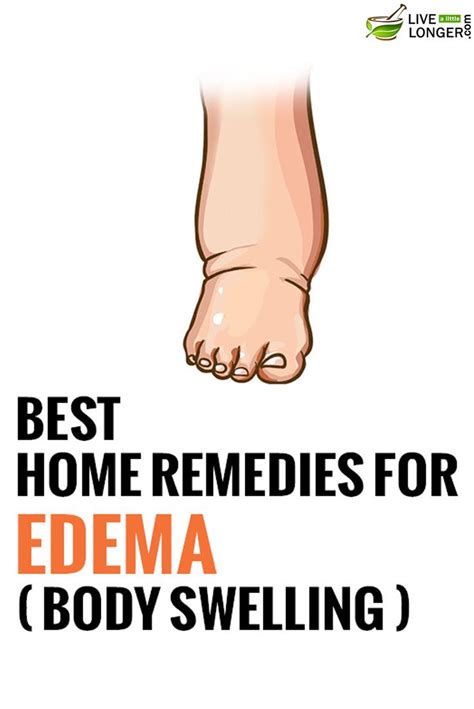 Pin On Health Home Remedies
