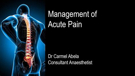 Management Of Acute Pain Youtube