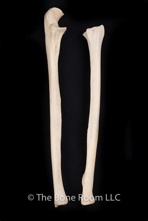 Choose from 500 different sets of flashcards about radius and ulna on quizlet. Human Radius & Ulna Set