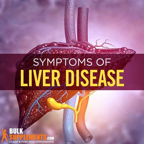 Liver Disease Symptoms Causes And Treatment