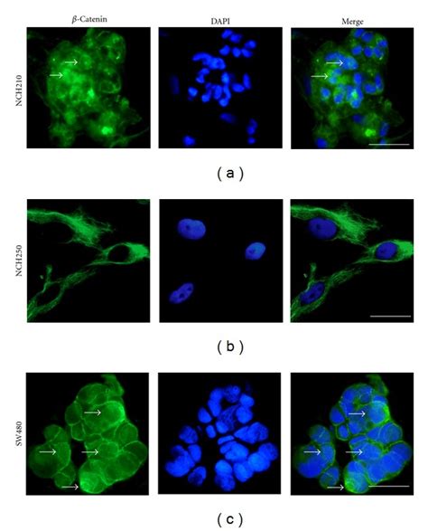 Immunofluorescent Staining Depicting Catenin Expression Patterns In