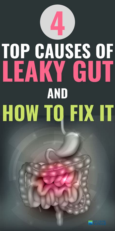 Pin On Gut Healing Recipes