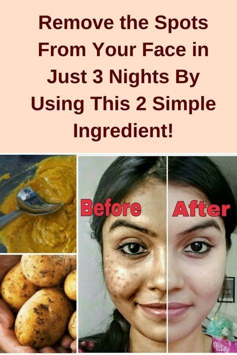 Pin By Yuli On Beauty Tips Remedies Skin Care Skin Care Secrets
