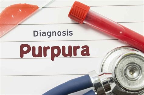 Purpura Causes Symptômes Et Traitements