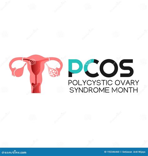 Vector Graphic Of Polycystic Ovary Syndrome Month Good For Polycystic Ovary Syndrome Celebration
