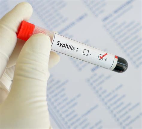 Syphilis Test Results