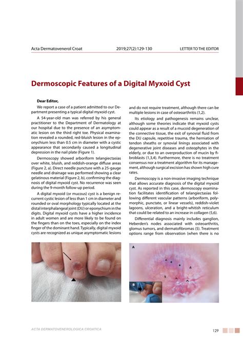 Pdf Dermoscopic Features Of A Digital Myxoid Cyst