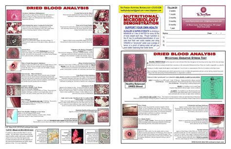 We have used this thinking to create the calculator below. Morgellons Disease Awareness - Live blood microscopy in a ...