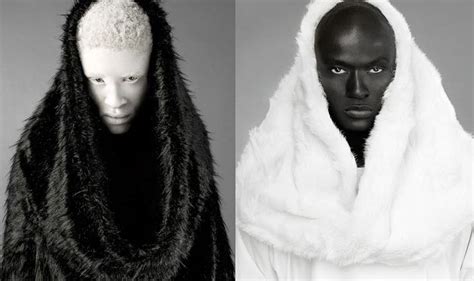 Facebook Shaun Ross Modelo Albino Vitiligo Treatment Style Ethnique