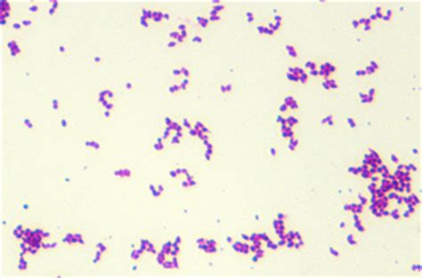 It is a facultative anaerobic bacterium, capable of surviving in the presence or absence of oxygen. UA-BW | Pseudotuberkulose- (Coryn...