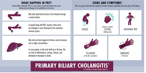 What Are The Signs Of The Deadly Disease Primary Biliary Cholangitis