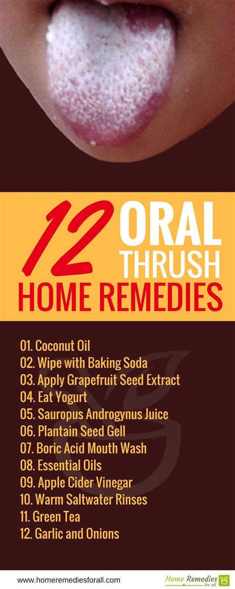 Use These Effective Home Remedies To Get Rid Of Oral Thrush Fast