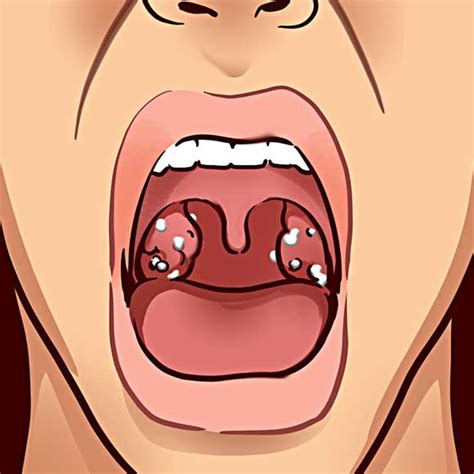 9 Things a Bad Taste in Your Mouth Is Trying to Tell You | Social Useful Stuff - Handy Tips