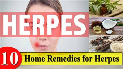 10 home remedies for herpes how to cure herpes naturally forever youtube