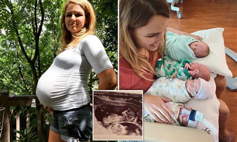Quadruplet Nine Month Pregnant Belly Pregnantbelly