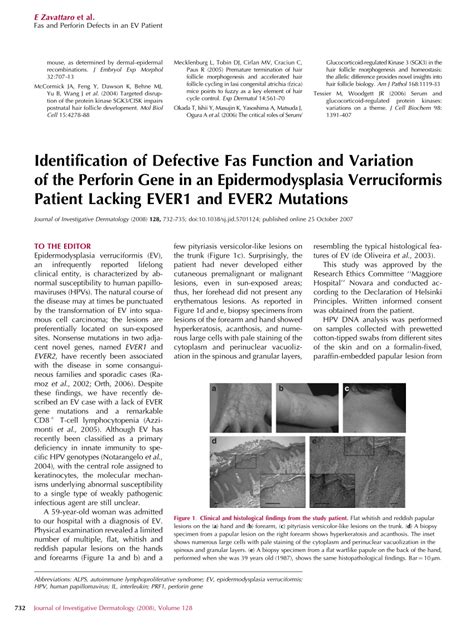 Pdf Identification Of Defective Fas Function And Variation Of The Perforin Gene In An