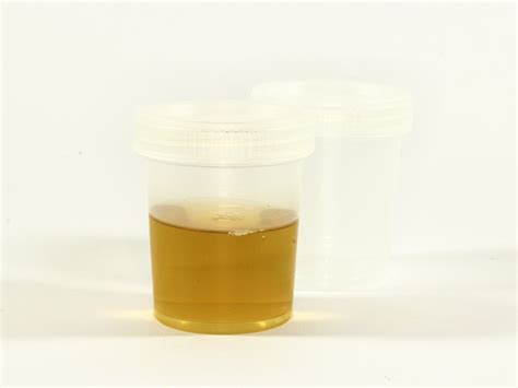 Is Urine Sterile And Other Questions About Using Pee In First Aid