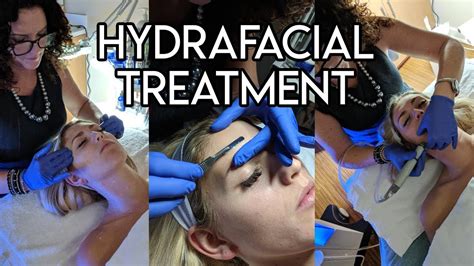 Hydrafacial Treatment Youtube