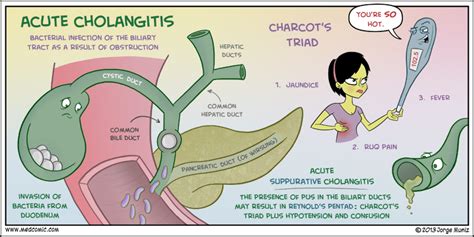 Acute Cholangitis Infographic Mediconet Blogspot REBEL EM