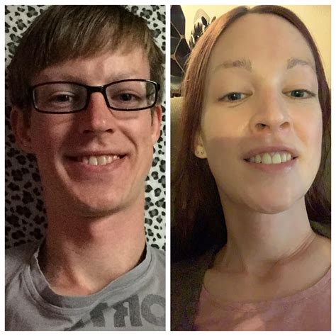 6 Years Between Photos Mtf 35 Years Hrt Multiple Rounds Of Ffs