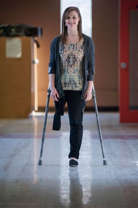Amputees Crutches Female