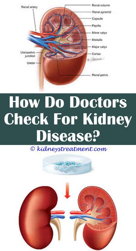 Itching From Kidney Or Liver Disease Kidausx